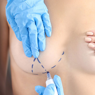 Breast Aesthetics in Guntur