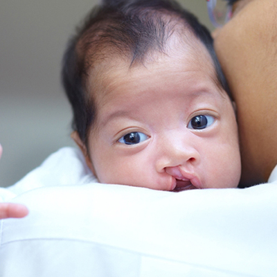 Pediatric Plastic Surgery in Guntur